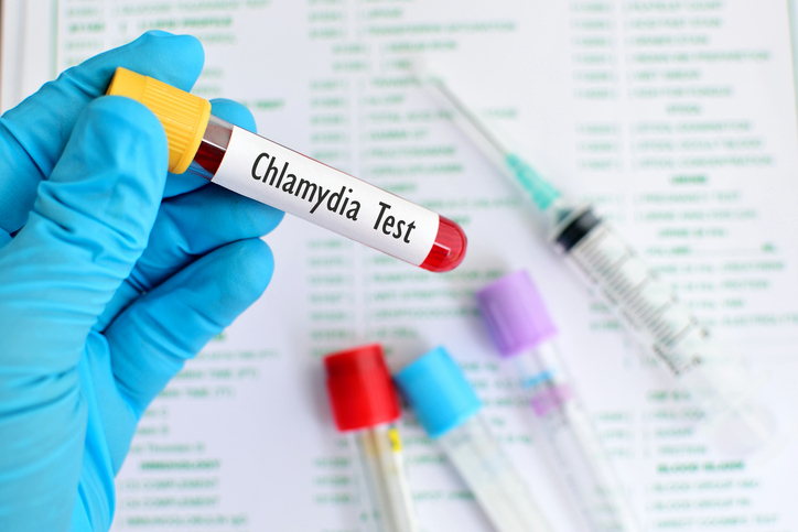 California STD Rates Continue to Rise, with Blacks and Latinos Often Hardest Hit – California Health Report